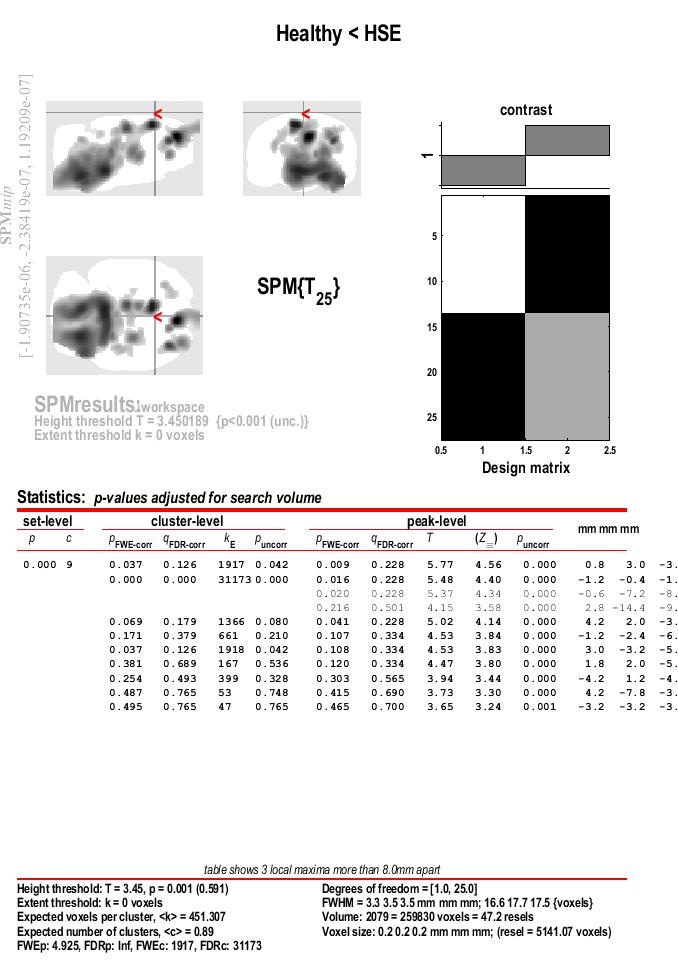 SPM Results: Uncorrected (First Step)