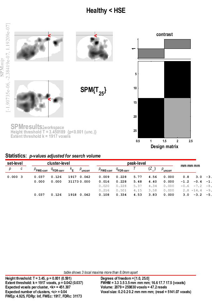 SPM Results: Corrected (Second Step)